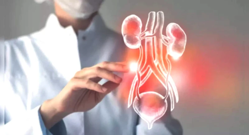 Boost Your Kidney Health: 3 Super Foods You Need to Try Now!